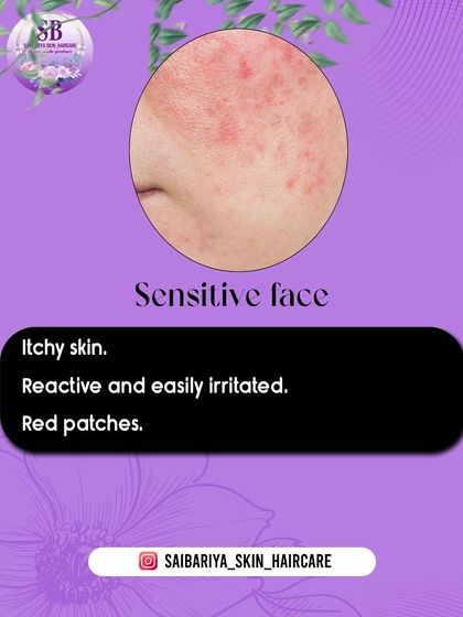 A close-up of sensitive skin, which can appear red and feel itchy. My products are formulated to be gentle and soothing for even the most reactive skin.