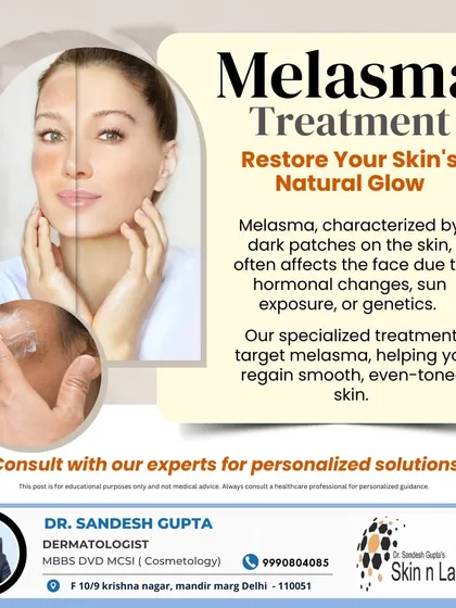This graphic explains my specialized treatment approach for melasma. It targets dark patches caused by hormones or sun exposure to help you regain smooth, even-toned skin. A personalized consultation is the first step.