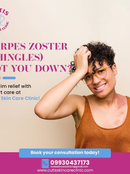 If Herpes Zoster, or Shingles, has got you down, we can help. Our clinic provides expert care, including antiviral therapy and gentle diagnosis, to relieve pain, promote healing, and prevent complications.