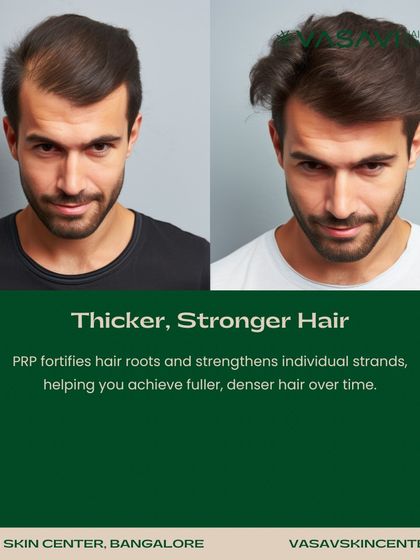 Sree Vasavi - Hair Loss & Regrowth Treatment Advanced Hair Regrowth Treatments photo 7