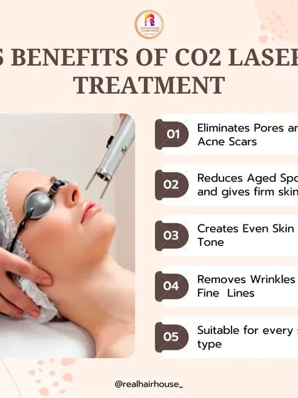 This infographic outlines the top 5 benefits of our CO2 laser treatment. It is an excellent solution for eliminating pores and acne scars, reducing age spots, creating an even skin tone, and removing fine lines.