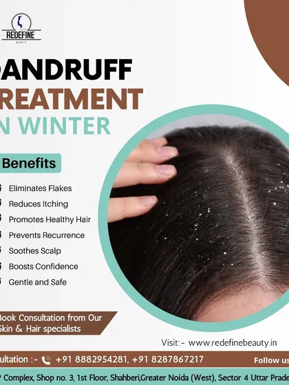 Dandruff can be especially stubborn in the winter. This graphic explains the benefits of our professional dandruff treatment, which soothes the scalp, eliminates flakes, and promotes healthy hair.