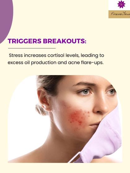 Stress increases the body's production of cortisol, a hormone that signals your glands to produce more oil. This excess oil can lead to clogged pores and frequent acne flare-ups, especially if you are already acne-prone.