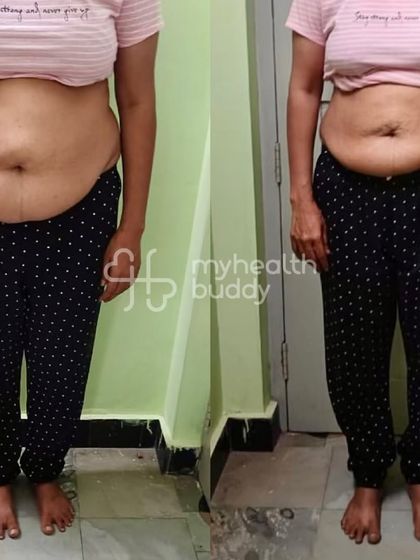 This school teacher, who manages thyroid and knee pain, lost over 6 kgs. She navigated work trips and functions by managing her portions wisely, proving that challenges can be overcome with the right guidance.