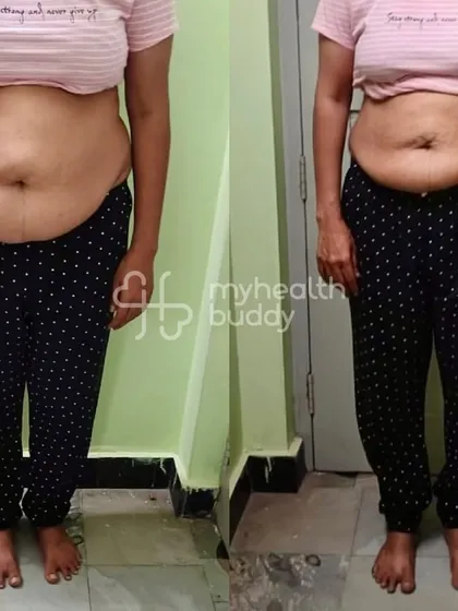 This school teacher, who manages thyroid and knee pain, lost over 6 kgs. She navigated work trips and functions by managing her portions wisely, proving that challenges can be overcome with the right guidance.