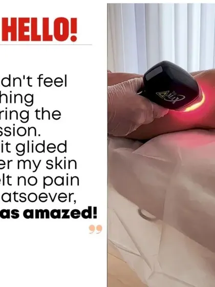 The most common feedback we receive is surprise at how comfortable the process is. Thanks to the advanced cooling technology of our Alma Soprano machine, our clients experience a truly pain-free session every time.