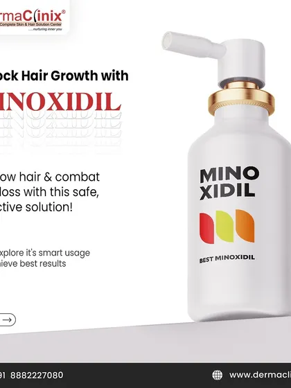 This post introduces the smart usage of Minoxidil, a safe and effective solution to regrow hair and combat hair loss.
