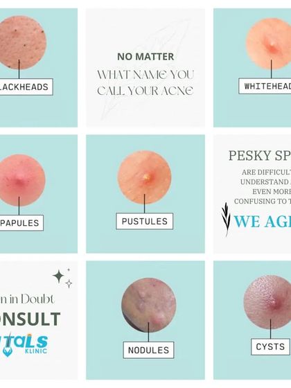 Vitals Klinic - Aesthetic Dermatology Acne & Scar Solutions photo 10