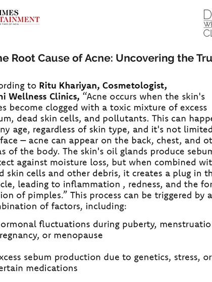 Featured in Times Entertainment, where I explain the root cause of acne as clogged pores from a mixture of sebum, dead skin cells, and pollutants.