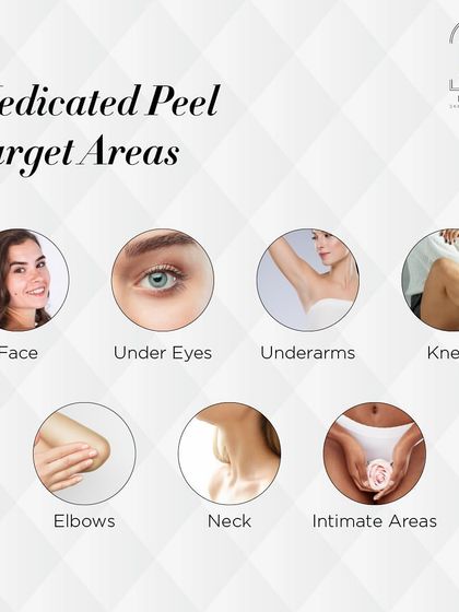 My medicated peels can be used on various target areas, including the face, under eyes, underarms, knees, elbows, neck, and intimate areas.