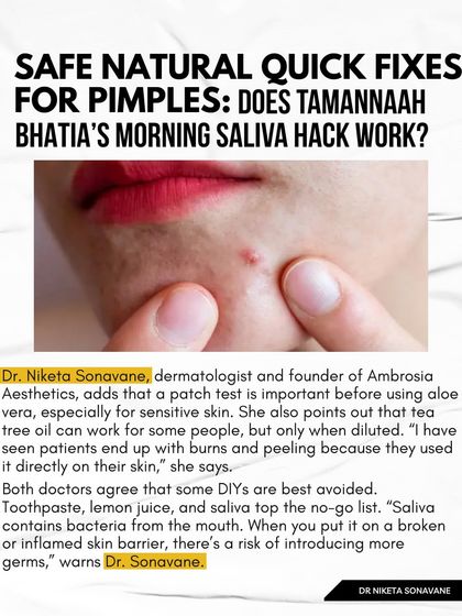 Does the morning saliva hack for pimples work? Absolutely not. As I shared with Manifest Magazine, saliva contains bacteria from the mouth that can introduce more germs to inflamed skin. Always avoid DIYs like this, along with toothpaste or lemon juice.