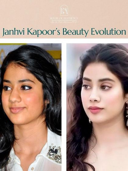 Janhvi Kapoor's beauty evolution is a great example of subtle enhancement. Strategic use of treatments like fillers, Botox, or HIFU can refine and sculpt features while maintaining a natural elegance.