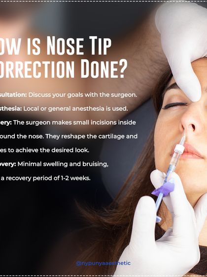 A nose tip correction involves a consultation to discuss goals, followed by a precise surgical procedure to reshape the cartilage. Recovery typically involves 1-2 weeks of minimal swelling.