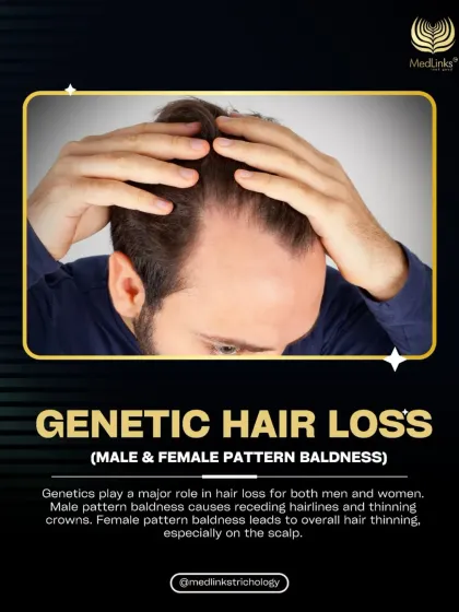 Genetics play a major role in hair loss for both men and women. Male pattern baldness typically causes receding hairlines and thinning crowns, while female pattern baldness often leads to overall thinning.
