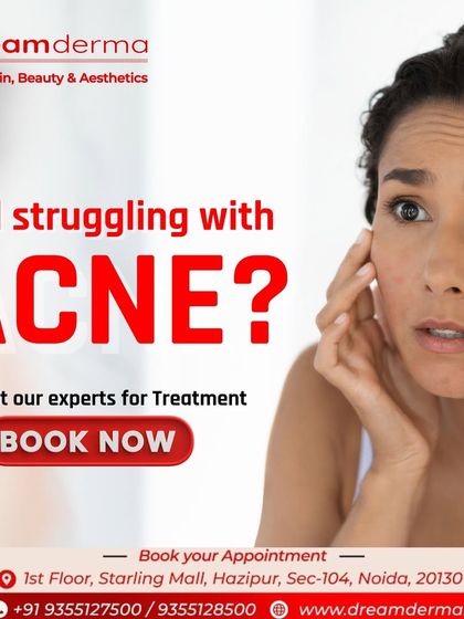 Still struggling with acne? You don't have to hide it or try ineffective home remedies. A consultation with our experts is the first step toward a personalized treatment plan that delivers real, lasting results for clear skin.