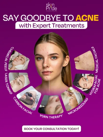 Acne can be frustrating, but we have a range of expert treatments to help. From medical facials and chemical peels to advanced laser therapies, we find the right solution for your specific skin concerns.
