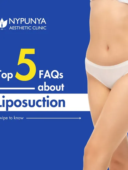 We get a lot of questions about liposuction. This series answers the top five frequently asked questions to give you a clear understanding of the procedure.