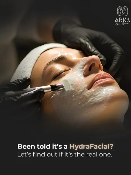 Many places offer facials, but are you getting an authentic HydraFacial? At my clinic, we use the real, US FDA-approved HydraFacial technology. This ensures you get the promised benefits of deep cleansing, extraction, and hydration safely.