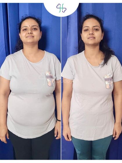 As a full time working mother of two, this client learned that consistency and self love are key. She lost 9 kgs in 6 months by following a flexible plan that fit her busy life, and she never doubted herself.