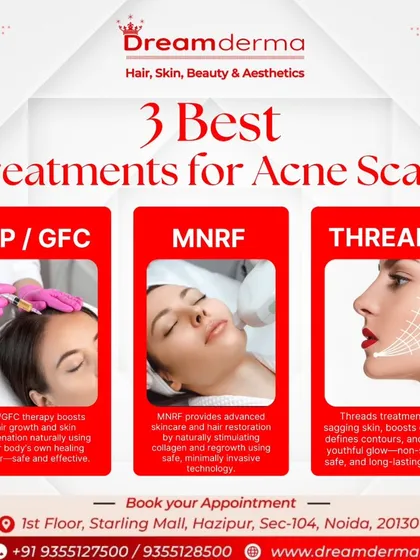 We have three powerful treatments to combat acne scars. This graphic explains how PRP/GFC uses your body's own healing power, MNRF stimulates collagen with minimally invasive technology, and Threads provide a non-surgical lift to smooth scarred areas.