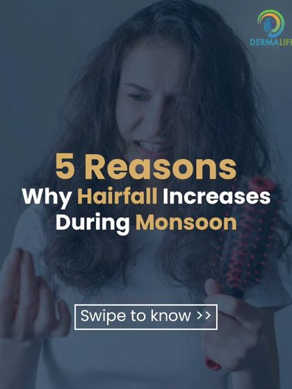 This carousel explains the 5 main reasons why hair fall increases during the monsoon season.