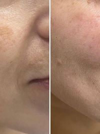 Cosmetic Dermatology