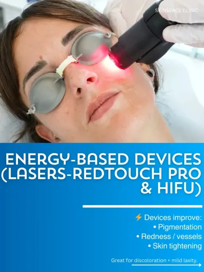 This is our RedTouch Pro laser in action, an energy-based device that is a cornerstone of our pre-wedding programs. It is excellent for improving pigmentation, reducing redness, and providing skin tightening, tackling concerns like discoloration and mild laxity to create a smooth, even canvas.