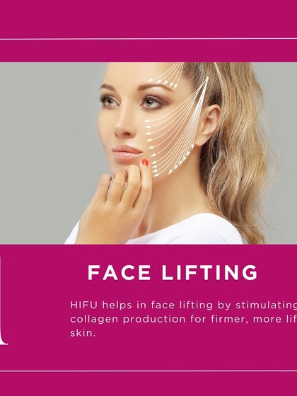 The primary benefit of HIFU is its face-lifting effect. By using focused ultrasound energy, I can stimulate deep structural layers of the skin to produce more collagen, resulting in a firmer, more lifted appearance without surgery.