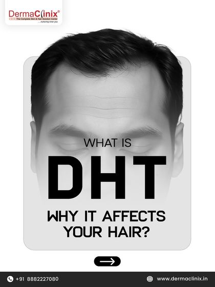 This graphic introduces DHT, the primary hormone responsible for shrinking hair follicles and causing thinning in both men and women.