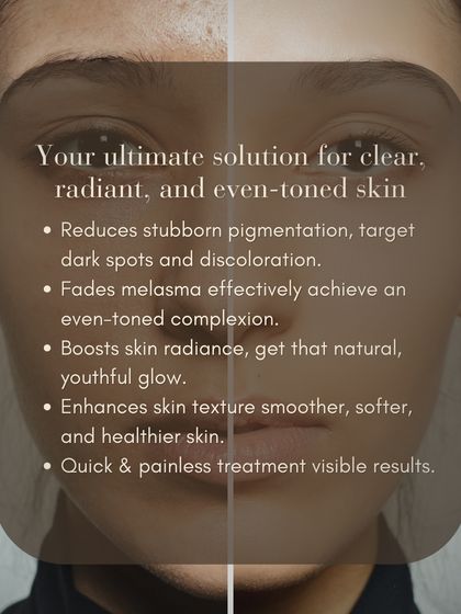 This is my ultimate goal for your skin: a clear, radiant, and even-toned complexion. Our treatments are designed to reduce stubborn pigmentation, fade melasma, boost radiance, and enhance skin texture, all through quick and effective clinical procedures.