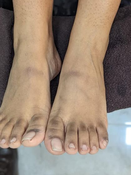 The "after" photo showcasing the results of our pedicure. Feet are visibly cleaner, smoother, and healthier after our comprehensive treatment.