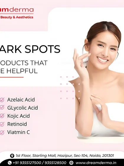 This educational graphic lists helpful ingredients for treating dark spots, such as Azelaic Acid, Glycolic Acid, and Vitamin C. We incorporate these powerful ingredients into our professional treatments for maximum efficacy.