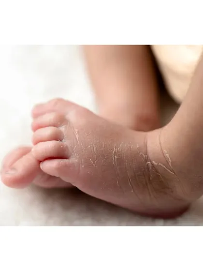 The tiny details are some of the most precious. I take close-up shots of those wrinkly little feet and peeling newborn skin, preserving the memory of just how small they were in their first few days.