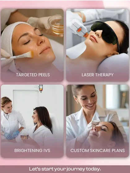 A glimpse into the comprehensive care we offer. This collage showcases some of our most popular services: targeted chemical peels for exfoliation, advanced laser therapy for rejuvenation, brightening IV drips for an inside-out glow, and the foundation of it all, custom skincare plans.