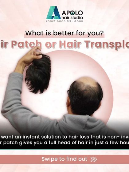 This image poses a common question: Hair Patch or Hair Transplant? A hair patch is the ideal choice if you want an instant, non-invasive solution that gives you a full head of hair in just a few hours.