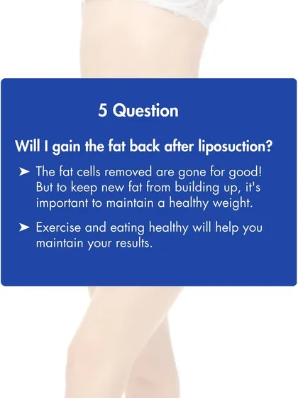Will the fat return after liposuction? The fat cells we remove are gone permanently. However, maintaining a stable weight through diet and exercise is key to preventing new fat from accumulating.