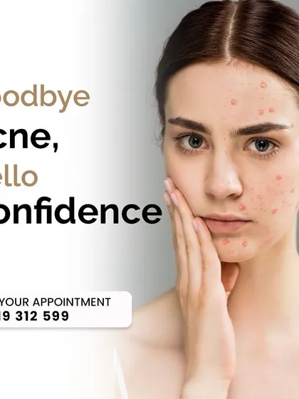 Say goodbye to acne and hello to confidence. My tailored treatments focus on the root causes of breakouts to help you achieve clear, healthy skin.
