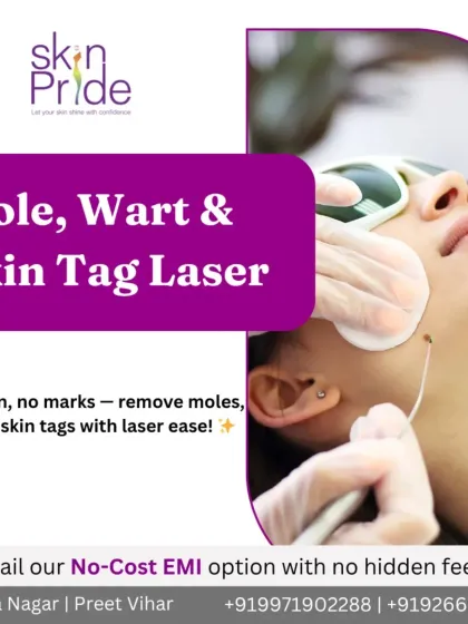 Clear skin means clear confidence. We use precise laser technology to safely remove moles, warts, and skin tags, helping you achieve the flawless skin you desire.