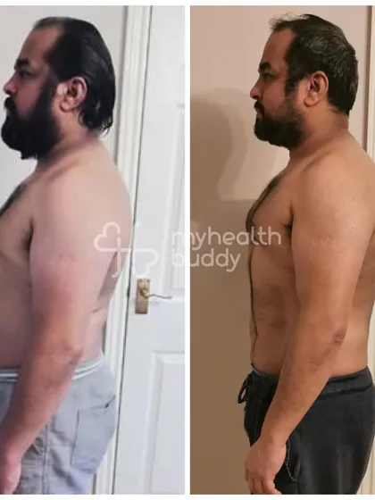 Vikas's side profile comparison. He successfully reduced his weight and improved his health markers by correcting his diet and staying consistent.