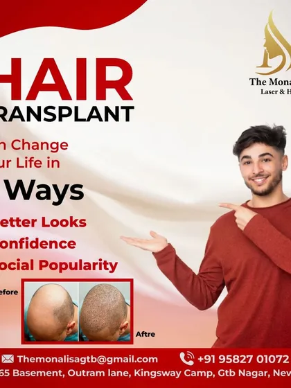 See the clear difference a hair transplant can make. This before and after image demonstrates the effective coverage and natural look we provide for our patients.
