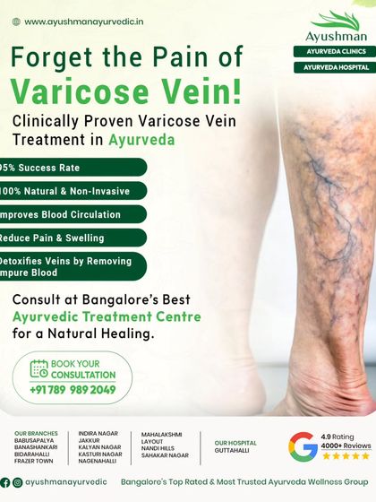 This visual details our clinically proven, non-invasive Ayurvedic treatment for varicose veins. With a 95% success rate, our therapy focuses on improving blood circulation, reducing pain and swelling, and detoxifying the veins naturally.