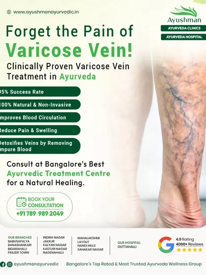 This visual details our clinically proven, non-invasive Ayurvedic treatment for varicose veins. With a 95% success rate, our therapy focuses on improving blood circulation, reducing pain and swelling, and detoxifying the veins naturally.