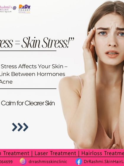 Rashmi's Skin Clinic - Acne & Scar Treatment The Science of Your Skin photo 12