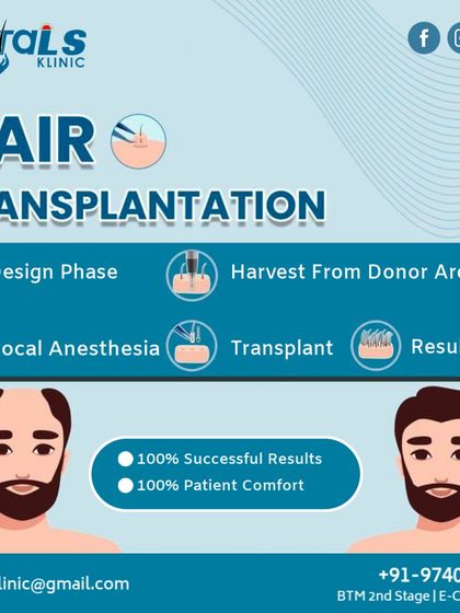 Vitals Klinic - Hair Restoration & Treatment FUE Hair Transplantation: A Permanent Solution photo 7