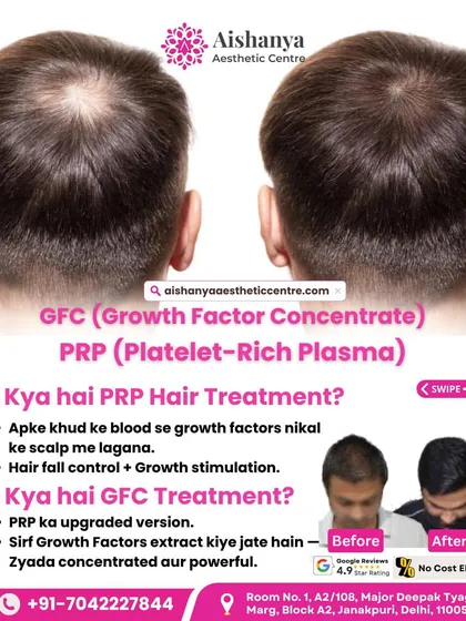 What is the difference between GFC and PRP? I explain how GFC is the upgraded, more powerful version of the trusted PRP treatment, offering more concentrated growth factors for better and faster results.
