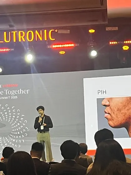 I was honored to speak at the Cynosure Lutronic APAC Summit 2025. Sharing my clinical experience on using Q-switched lasers for treating pigmentation issues in Indian skin with my peers is a vital part of advancing our collective knowledge and improving patient outcomes.