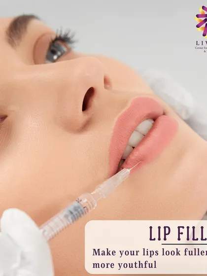 Lip fillers are a popular choice for adding volume and definition. This image shows the precision involved in the procedure, which I use to enhance the natural shape of the lips for a fuller, more balanced look.