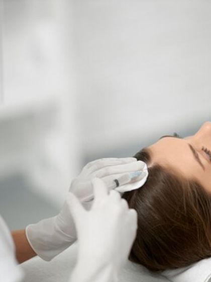 This image shows a GFC treatment for hair loss. GFC is more potent than traditional PRP, offering more targeted outcomes with fewer sessions for improving hair density and scalp health.