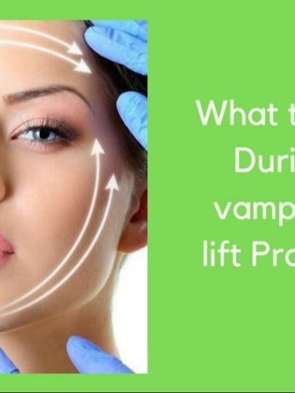 This graphic explains what to expect during a Vampire Facelift procedure. I ensure patient comfort throughout the process, which is designed to deliver a radiant, dew-like glow over time.