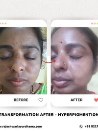 Ayurvedic Skin & Hair Treatments